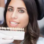 Hollywood Smile Cost in Istanbul 2025